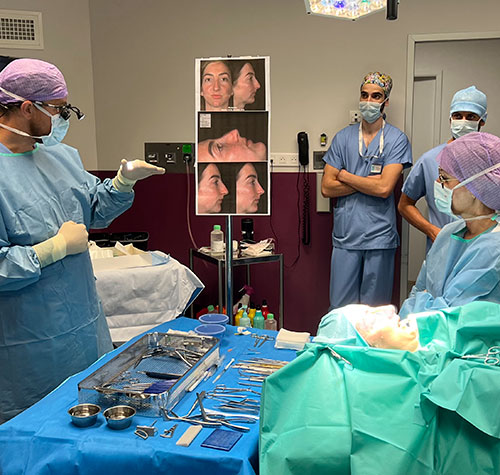 Live Rhinoplasty Course in Montpellier