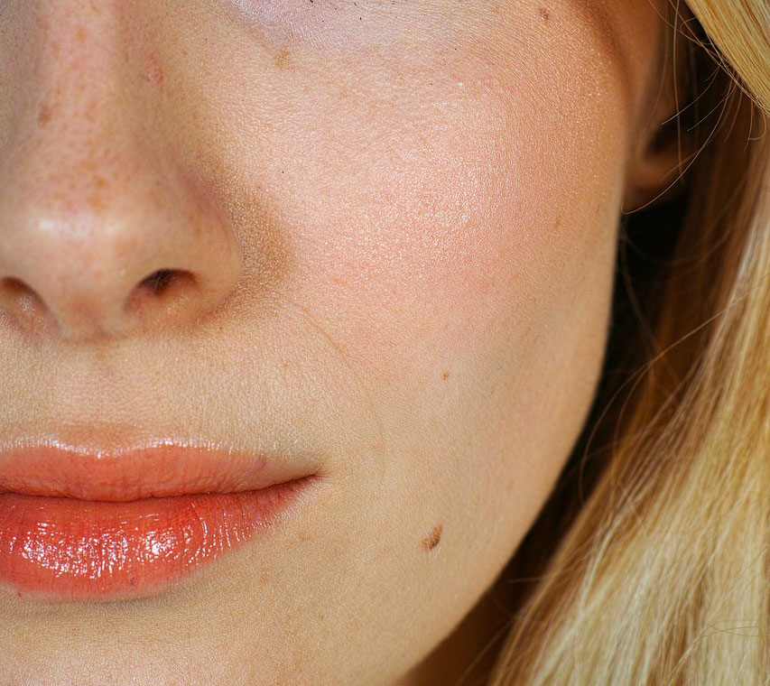 Les raisons médicales d'une rhinoplastie